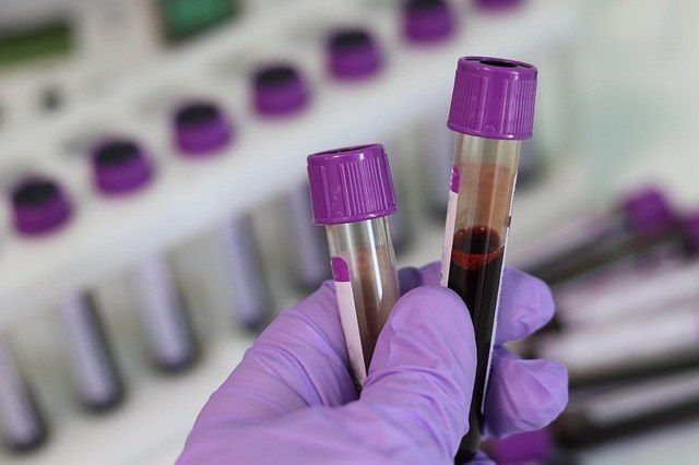 exame-sangue - (Foto: Pixabay)