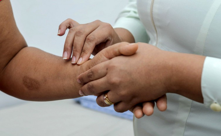 Doença tem tratamento gratuito pelo SUS - Foto: Raiza Milhomem/Semus Palmas