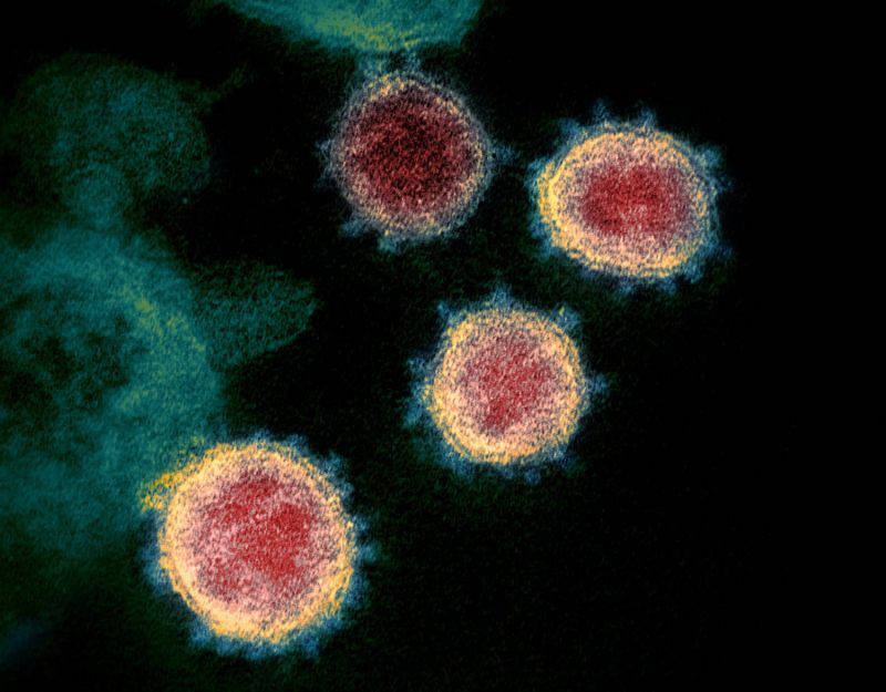 Medicamento é capaz de neutralizar vários tipos de coronavírus - (Foto: Reprodução/NIAID)
