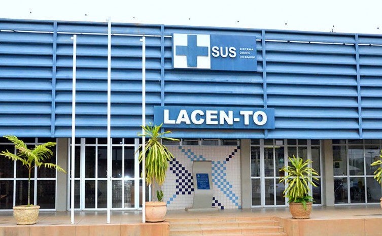 Lacen/TO envia semanalmente amostras à Fiocruz e conta ainda com parceria com a UFT - Foto: André Araújo/Governo do Tocantins