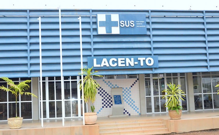 Material está disponível nas unidades do Lacen-TO em Palmas e Araguaína - Foto: André Araújo/Governo do Tocantins