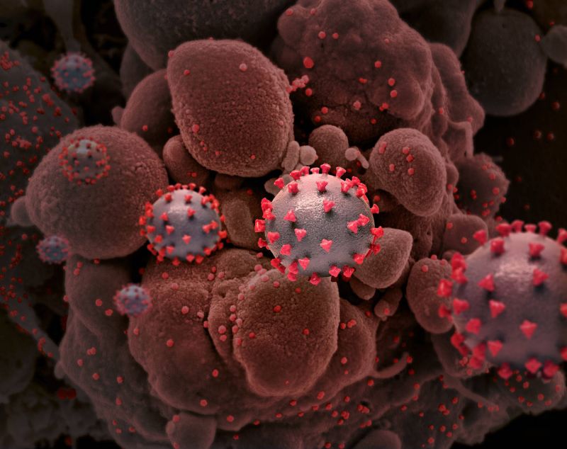 Células T não impedem infecção, mas atuam no combate à doença - (Foto: Divulgação/National Institute of Allergy and Infectious Diseases)