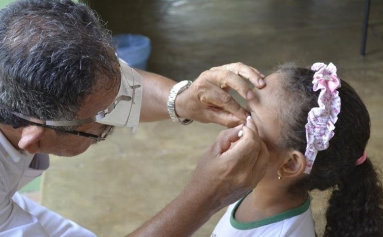 Tratamento do Tracoma é realizado pelo Sistema Único de Saúde gratuitamente - Foto: Juliana Matos/Governo do Tocantins