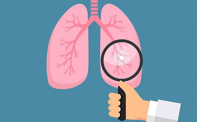 A doença é causada pela bactéria Mycobacterium tuberculosis que ataca principalmente os pulmões - Foto: SES/Governo do Tocantins