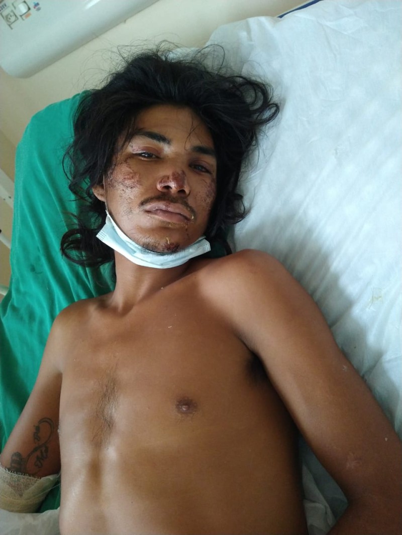 Foto: Reprodução/Secom Amazonas
