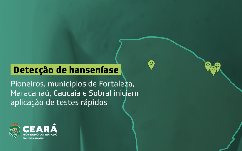 Foto: Reprodução/Secom Ceará